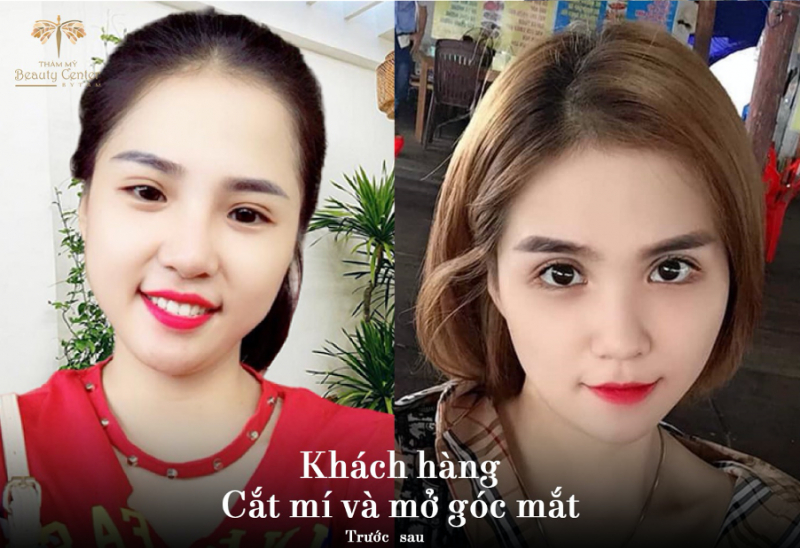 Thẩm mỹ Beauty Center – by Tấm